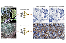 Deep Learning-Based Virtual Staining of Tissue Facilitates Rapid Assessment of Breast Cancer Biomarker