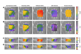 UCLA Study Reveals Complex Muscle Control Behind Blinking and Eyelid Function