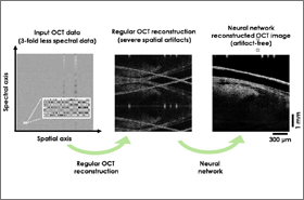Deep Learning Improves Image Reconstruction in Optical Coherence Tomography 