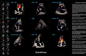 Bioengineering Doctoral Student Co-Authors AI Heart Model Paper Published in Nature
