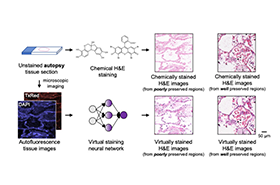 UCLA Unveils AI-Powered Autopsy Tissue-Staining Method Using Deep Learning