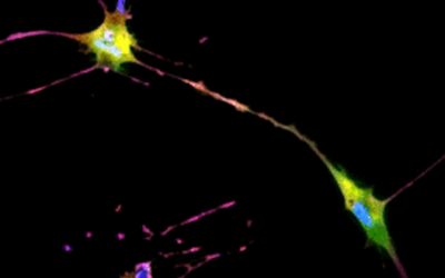 UCLA Researchers Develop New, Noninvasive AI Method to Inspect Live Cells and Gain Critical Data