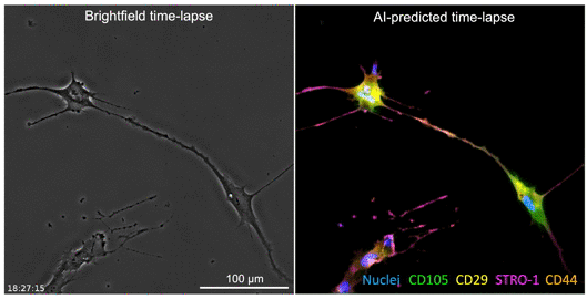 The developed AI algorithm can transform a brightfield image (left) into a fluorescent-like image (right) without sacrificing the cells to obtain.