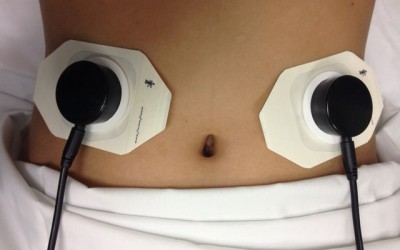 FDA Approves Use of UCLA-created Wearable Device to Address Gastrointestinal Disorders