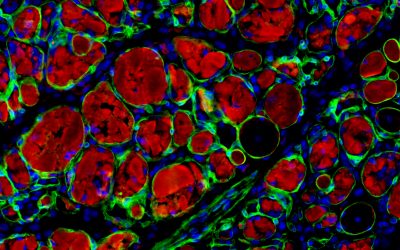 Chemical cocktail creates new avenues for generating muscle stem cells