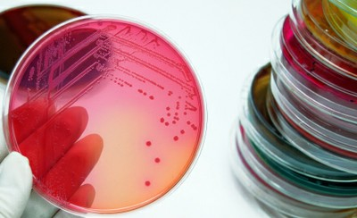 UCLA Researchers Engineer E. coli to Produce Record-Setting Amounts of Alternative Fuel
