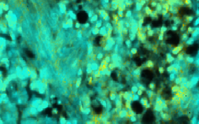 UCLA Bioengineer Advances Ultrafast, High-Res Microscopic Imaging Technique Using Fluorescence