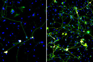 In body image_neurons