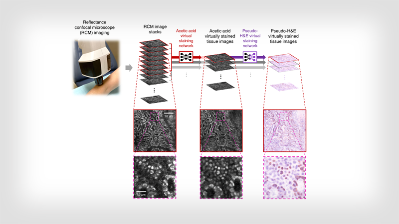 UCLA team achieves biopsy-free virtual histology of skin using deep learning and RCM.