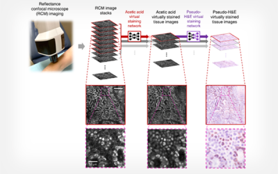 New Imaging Technology Developed by UCLA Research Team May Reduce Need for Skin Biopsies