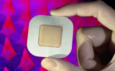 UCLA Researchers Develop Coin-Sized Smart Insulin Patch