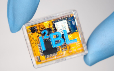 Skin-Deep Microneedle Sensor Tracks Drug Clearance and Reveals Early Kidney and Liver Dysfunction