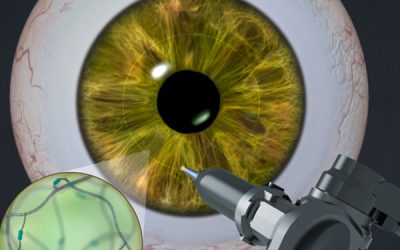 Adhesive gel helps the eye heal itself