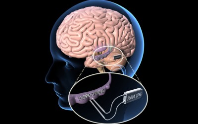 UCLA Engineering Plays Key Role in DARPA ‘Neuroprosthesis’ Research