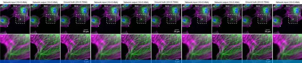 Deep learning takes fluorescence microscopy into super resolution ...