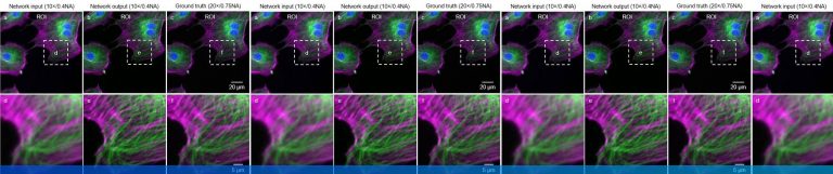Deep learning takes fluorescence microscopy into super resolution ...