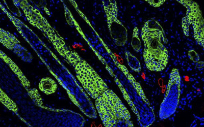 New Wound-Healing Biomaterials Reduce Scarring and Promote Tissue Regeneration