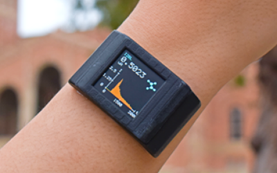 Adhesive Film Turns Smartwatch into Biochemical Health Monitoring System