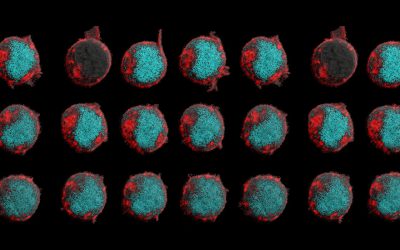 UCLA researchers show a cancer defense mechanism could be turned back to attack tumors